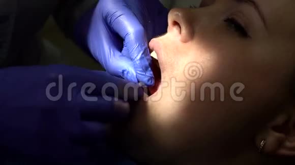 牙医在诊所给她的病人刷牙视频的预览图