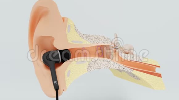 内耳被耳机损坏视频的预览图