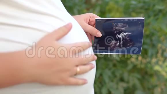 孕妇将超声波扫描照片或照片放在未来女儿或儿子的腹部女孩视频的预览图