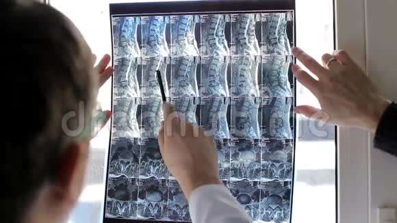 两名医生在医院检查病人X光视频的预览图