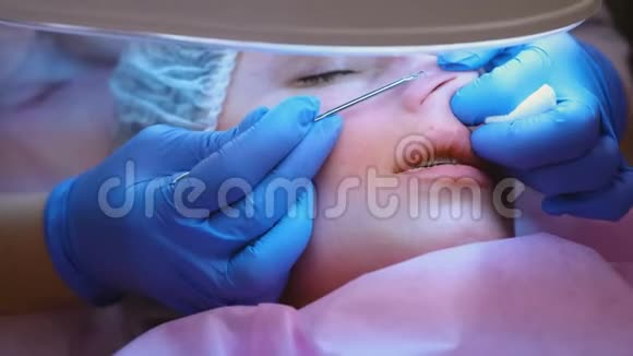美容师的面部机械清洁美容师把粉刺挤在病人鼻子上视频的预览图