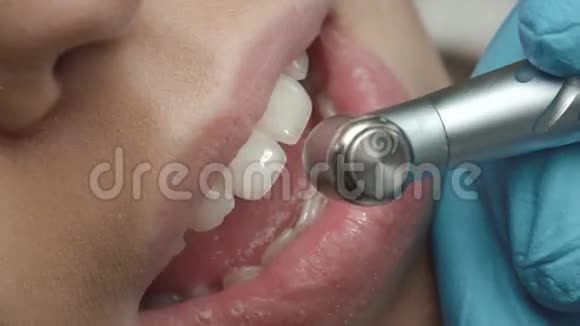 专业的牙科清洁牙医的病人女孩的大嘴巴视频的预览图