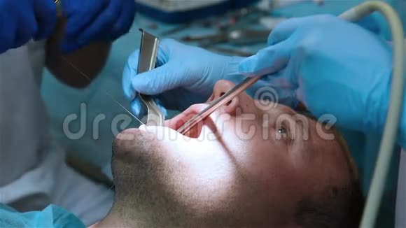 牙科缝合胶视频的预览图
