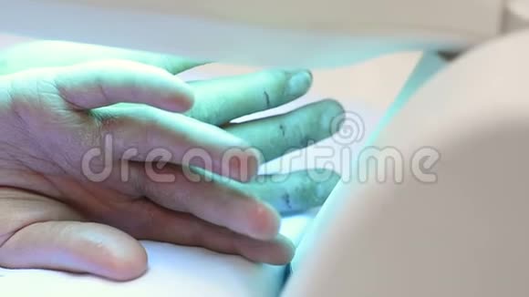 银屑病患者的手在紫外线灯下特写视频的预览图