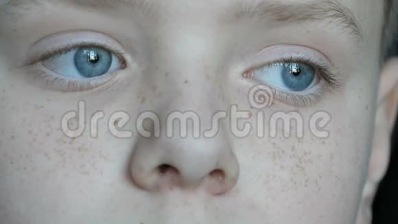 体贴的脸蓝眼睛长雀斑的男孩视频的预览图
