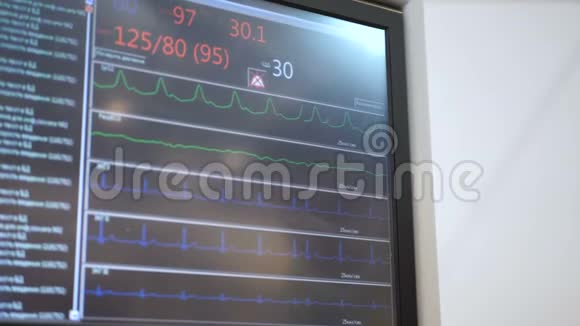 心电监护患者在手术室病情关闭屏幕上的心跳心率血压背景视频的预览图