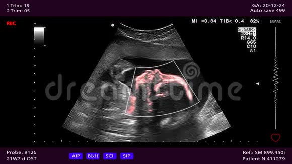 孕期医学超声检查视频的预览图