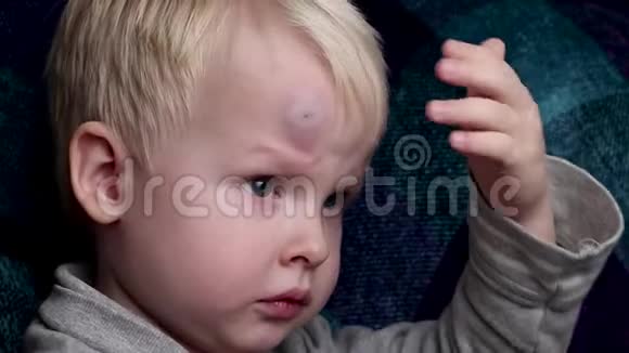 一个小男孩额头上的一块大瘀伤视频的预览图