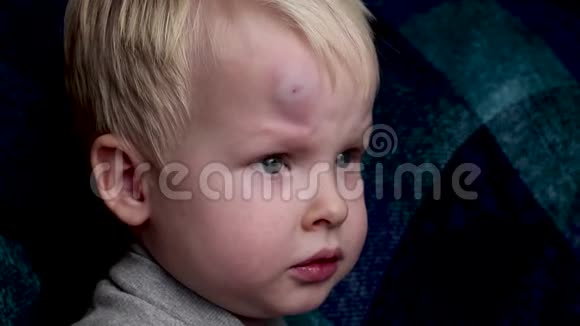 一个小男孩额头上的一块大瘀伤视频的预览图