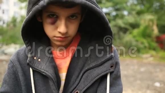 这个男孩是一个十几岁的孩子有一个血肿眼睛擦伤看着相机视频的预览图