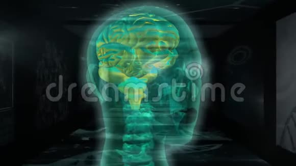 她脑部核磁共振扫描的动画视频的预览图