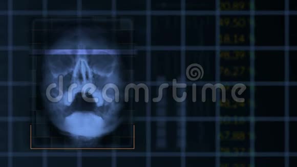 扫描一个人的头骨循环蓝泥接口医疗设备视频的预览图