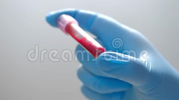带保护手套的女实验室技术人员拿着移液管在医院病房检测血液样本视频的预览图