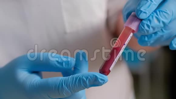 带保护手套的女实验室技术人员拿着移液管在医院病房检测血液样本视频的预览图
