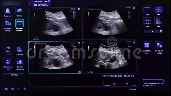 用人体内脏图像显示超声电子设备不同观点的图片视频的预览图