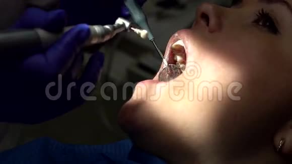 牙医专业清洁女孩的牙齿视频的预览图