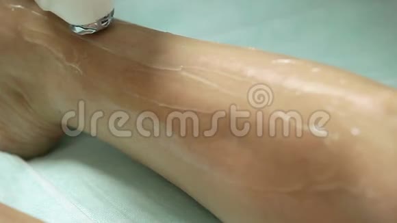 美容师对病人的腿做激光脱毛脱毛程序视频的预览图