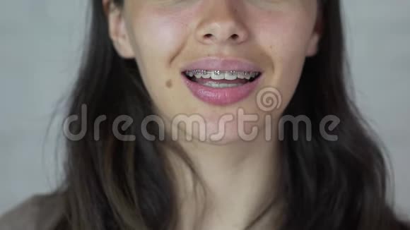 戴牙套的年轻女孩看着摄像机微笑着快关门视频的预览图