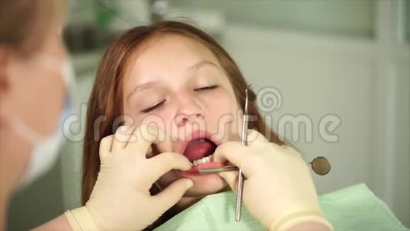 牙齿矫正器检查一名来诊所治疗的青少年的牙齿视频的预览图