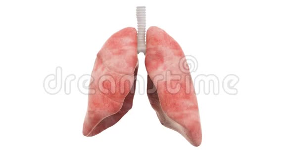 疾病在肺部传播三维动画3D染色与白色背景隔离视频的预览图