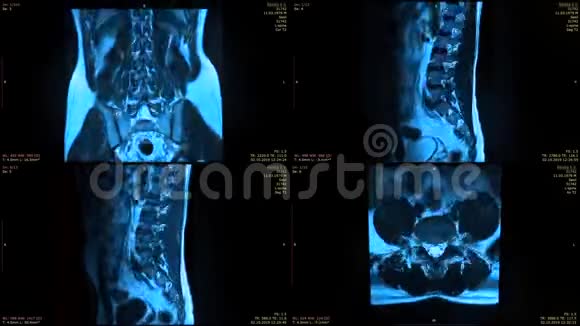四张MRI图像的分割屏幕视频的预览图