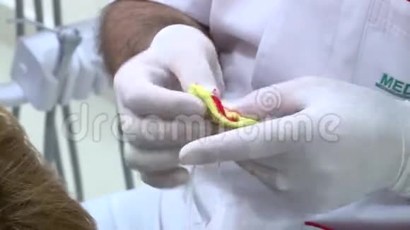 牙医取牙印视频的预览图
