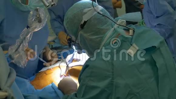 外科医生切割组织视频的预览图