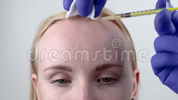 美容或头发移植美容医生在女性头部注射头发或防止头发生长视频的预览图
