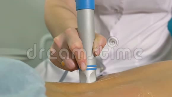 女性背部EPAT装置管的特写视频的预览图