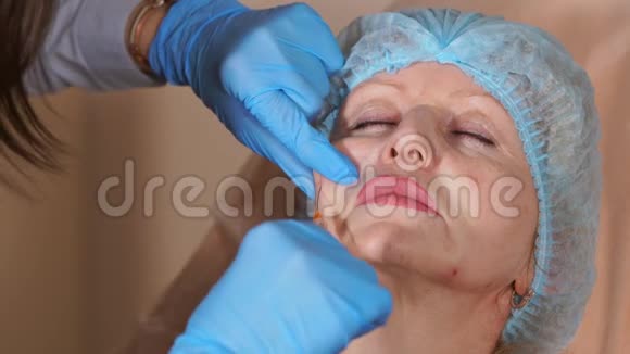 美容师医生把套管注入一位中年妇女的脸颊视频的预览图