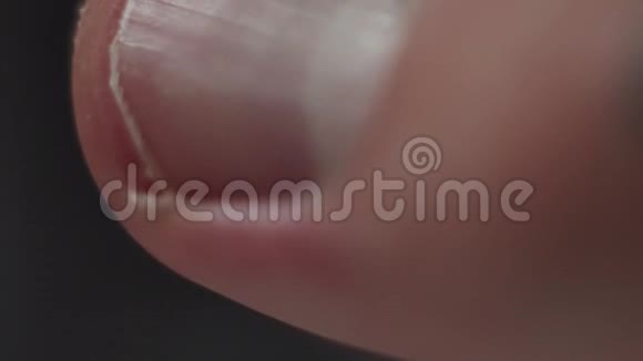 人的手臂拇指指甲大关视频的预览图