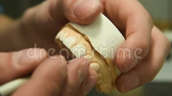 牙医做种植牙视频的预览图