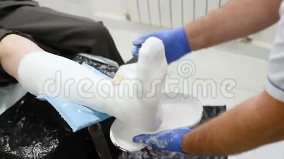 医生创伤学家在病人的腿上贴了一块石膏视频的预览图