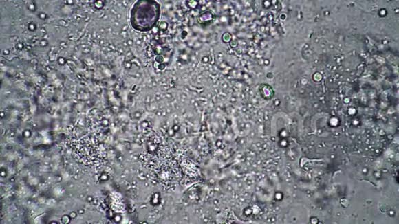 显微镜下牛奶发酵中的乳酸杆菌视频的预览图
