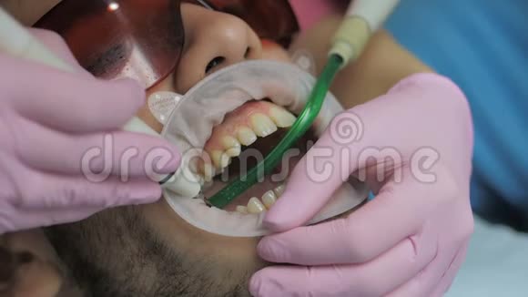 在诊所为一名专业的牙科抛光师提供贴身服务视频的预览图
