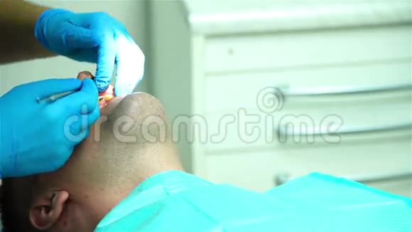 牙科设备植入视频的预览图