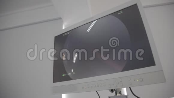 一台医疗设备背景特写超声机超声诊断设备视频的预览图