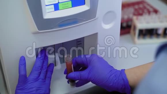 一名医生用橡胶手套他的手用一种现代医疗器械进行尿液分析视频的预览图