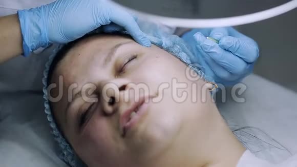 美容师用针头清洁痤疮的面部视频的预览图
