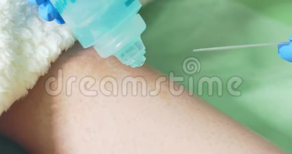 医生在美容过程中使用凝胶激光脱毛和美容美容水疗诊所视频的预览图