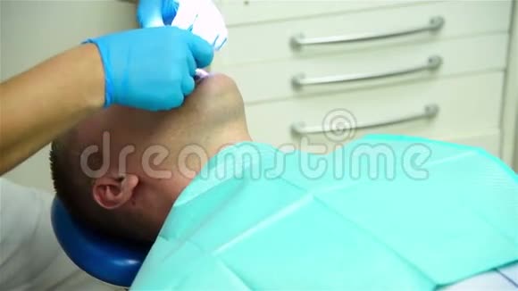 牙科印象过程视频的预览图