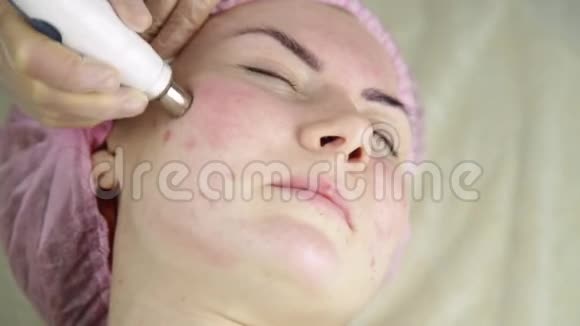 有皮肤问题的年轻女性用医疗设备做美容视频的预览图