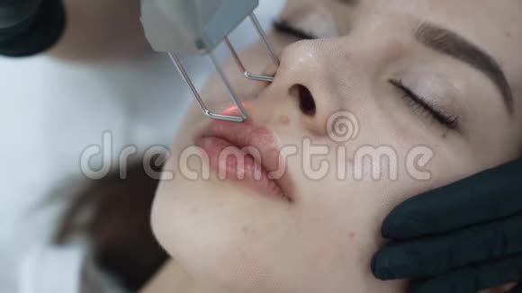临床激光面部治疗中年轻女性面部特写慢动作视频的预览图