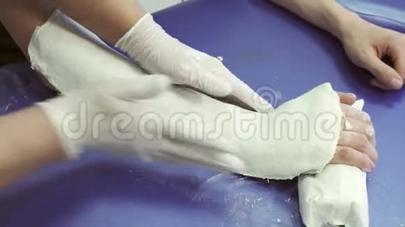 创伤科医生给手臂病人抹上石膏绷带视频的预览图