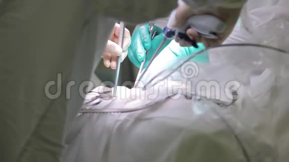 两名外科医生利用创新医疗技术进行肿瘤手术视频的预览图