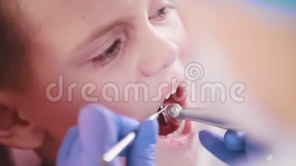 牙医牙医在打磨小孩的牙齿视频的预览图