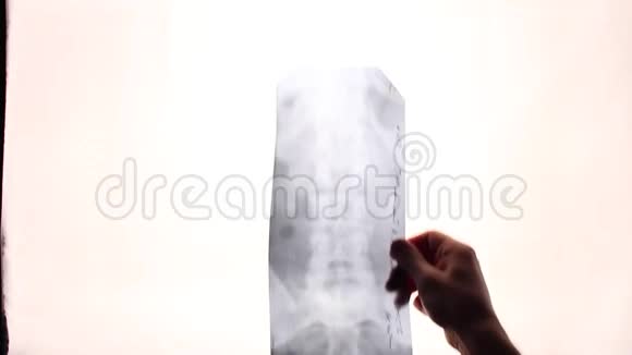 放射科医生手里拿着X光视频的预览图