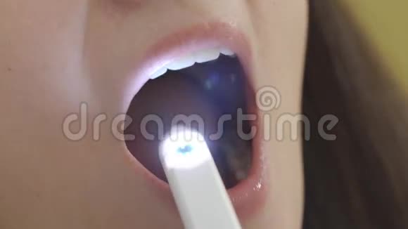 特写牙医用口腔内摄像机检查病人的口腔视频的预览图