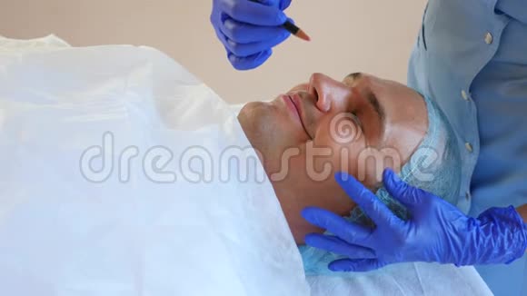 美容师用铅笔在一个人的脸上做标记整形手术轮廓面塑料为男性4k视频的预览图