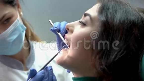 牙医张口病人视频的预览图